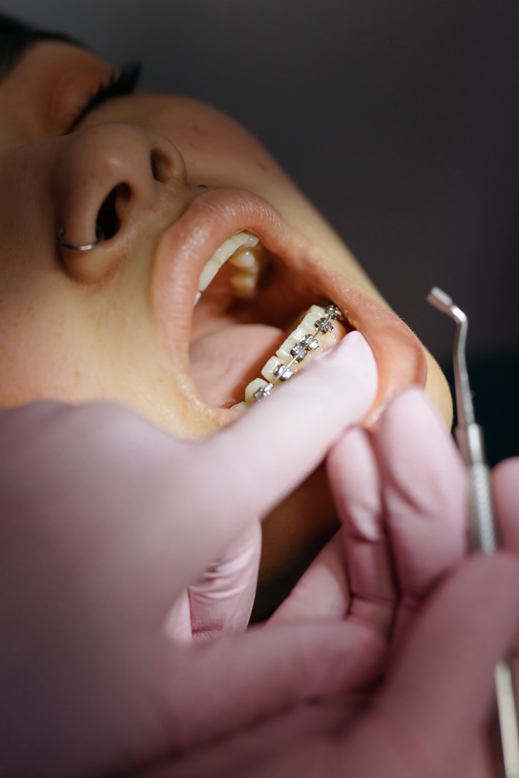 Best Dental Clinic In Panchkula Top Dentist In Panchkula Near Sector 20