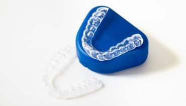 BRACES AND ALIGNERS